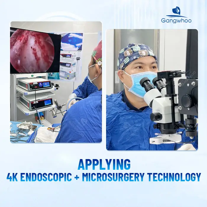 How Much Does Nose Revision Surgery Cost? 2025 Nose Revision Price Guide