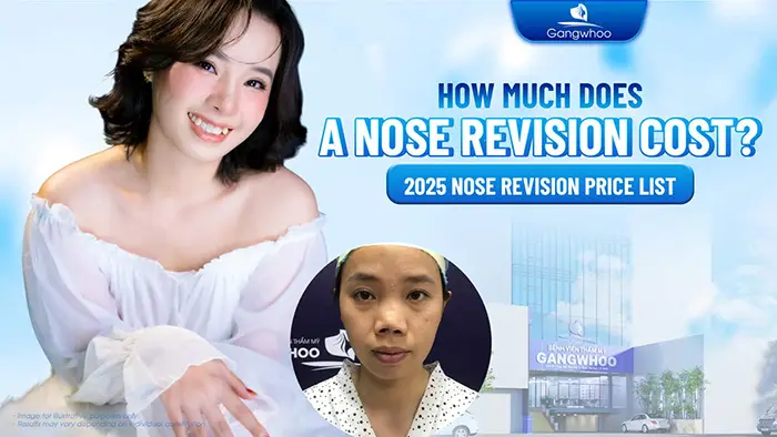 How Much Does Nose Revision Surgery Cost? 2025 Nose Revision Price Guide
