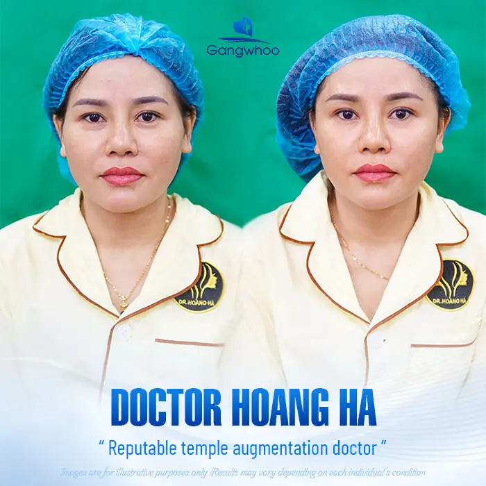 Top 5 Reputable, Highly Qualified Temple Augmentation Doctors Today