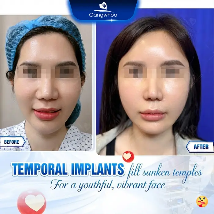 Top 5 Reputable, Highly Qualified Temple Augmentation Doctors Today