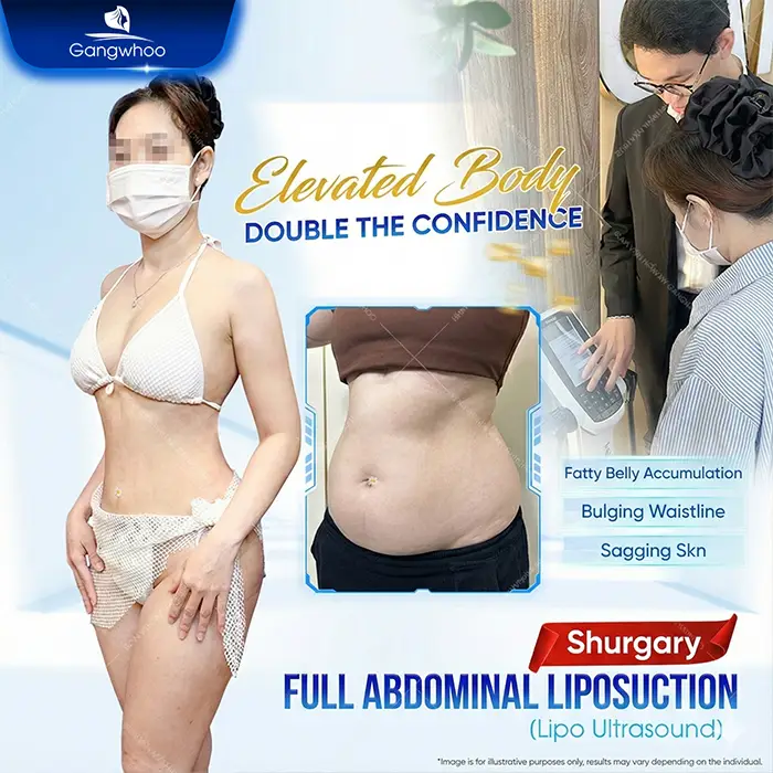 Top 10 Highly Reputable and Skilled Belly-Fat Liposuction Doctors in Ho Chi Minh City