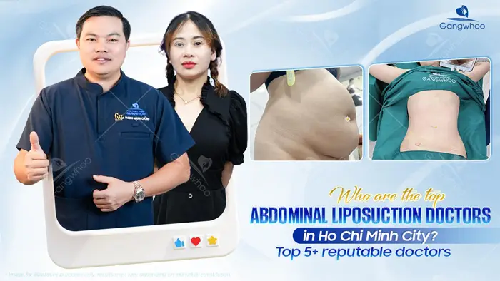 Top 10 Highly Reputable and Skilled Belly-Fat Liposuction Doctors in Ho Chi Minh City