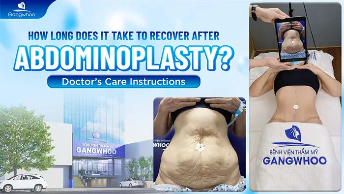Abdominoplasty Recovery Time: Doctor’s Complete Post-Operative Care Guide