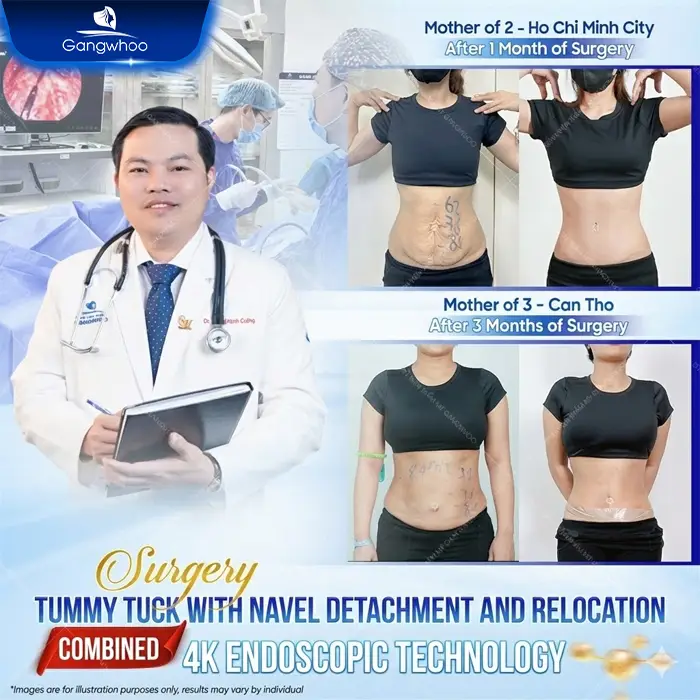 Does a Tummy Tuck Hurt? Effective Ways to Reduce Pain