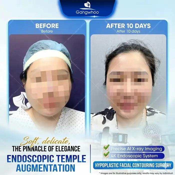 Top 10 Reputable and Safe Temple Augmentation Clinics in Ho Chi Minh City