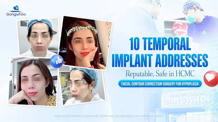 Top 10 Reputable and Safe Temple Augmentation Clinics in Ho Chi Minh City