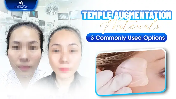 Temple Augmentation Materials: 3 Commonly Used Options