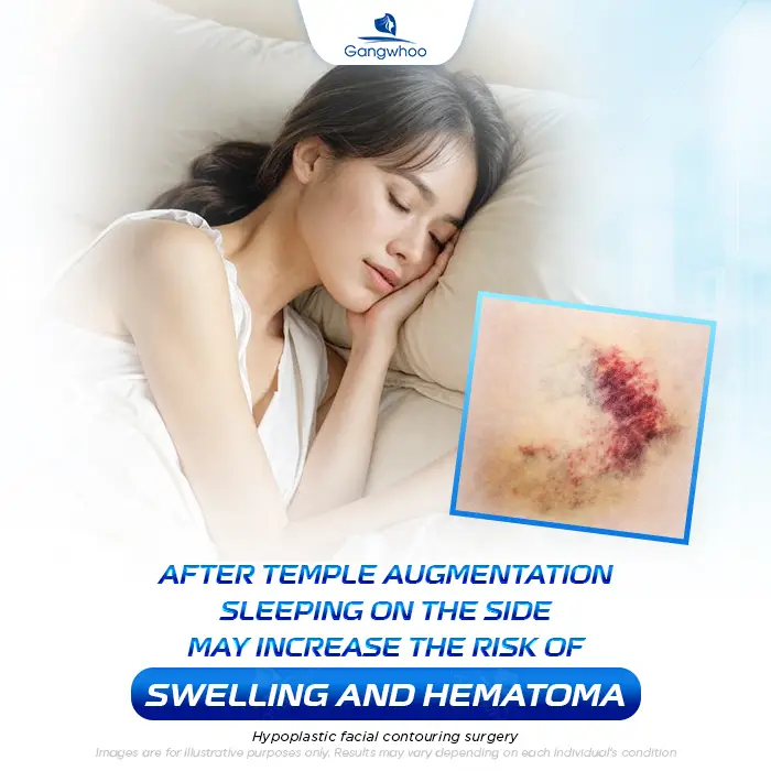 How Long After Temple Augmentation Can You Sleep on Your Side? Doctor’s Explanation