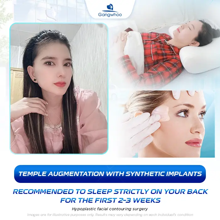 How Long After Temple Augmentation Can You Sleep on Your Side? Doctor’s Explanation