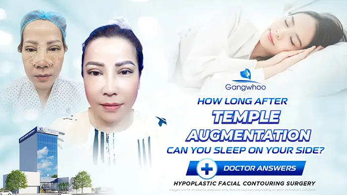 How Long After Temple Augmentation Can You Sleep on Your Side? Doctor’s Explanation