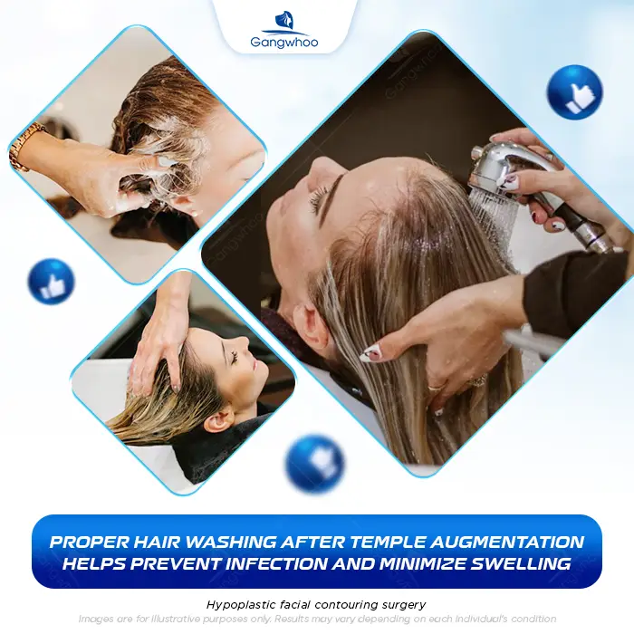 How Long After Temple Augmentation Can You Wash Your Hair? Proper Hair-Washing Guidelines