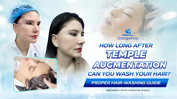 How Long After Temple Augmentation Can You Wash Your Hair? Proper Hair-Washing Guidelines