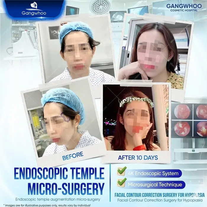 Will Temple Augmentation Be Visible? Causes and Treatment Options