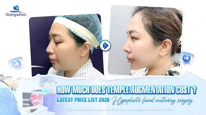 How Much Does Temple Augmentation Cost? Latest Price List for 2026