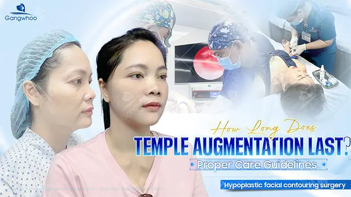 How Long Does Temple Augmentation Last? Proper Aftercare Guidelines