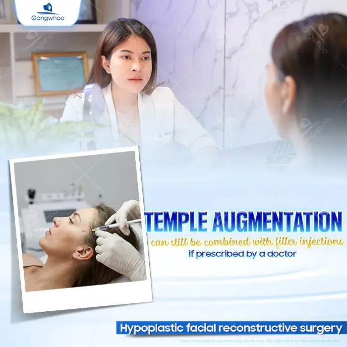 Can You Get Filler Injections After Temple Augmentation? Expert Answers from a Specialist