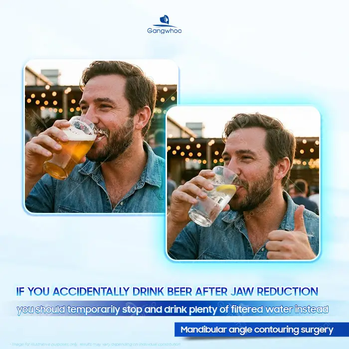 How Long After Jaw Reduction Surgery Can You Drink Beer? A Doctor Explains