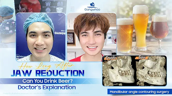 How Long After Jaw Reduction Surgery Can You Drink Beer? A Doctor Explains