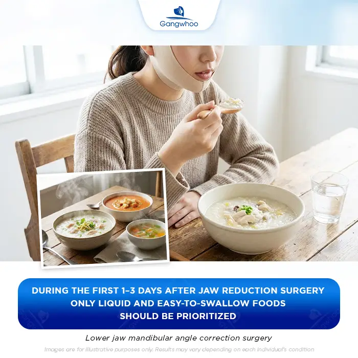 How Long After Jaw Shaving Can You Eat? A Safe Post-Surgery Eating Timeline