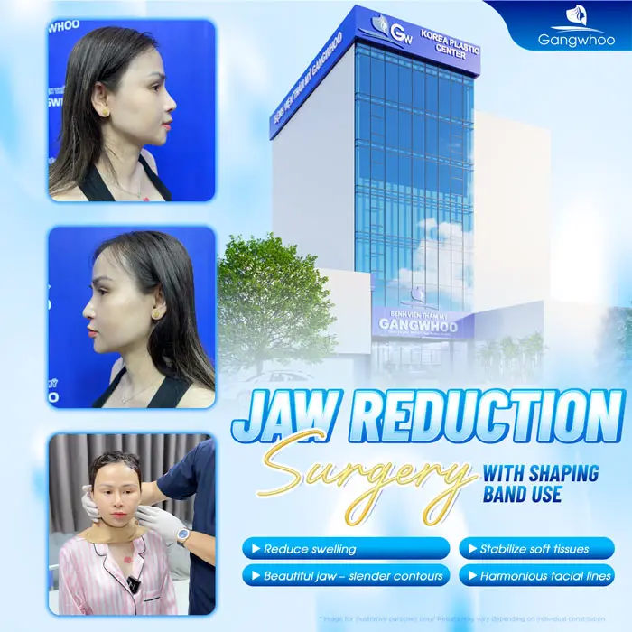 How Long Should You Wear a Compression Garment After Jaw Reduction Surgery? Proper Wearing Guidelines