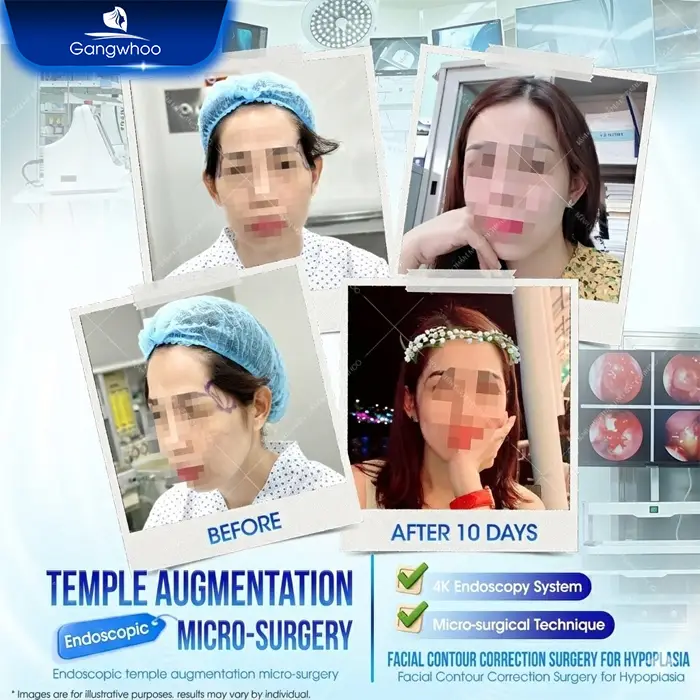Doctor’s Guide to Post-Temple Augmentation Aftercare