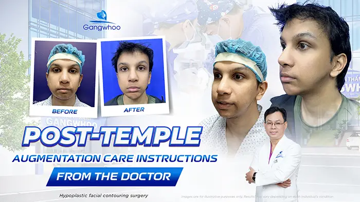 Doctor’s Guide to Post-Temple Augmentation Aftercare