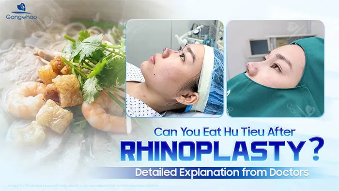 Can You Eat Hu Tieu After Rhinoplasty? A Doctor’s Detailed Explanation