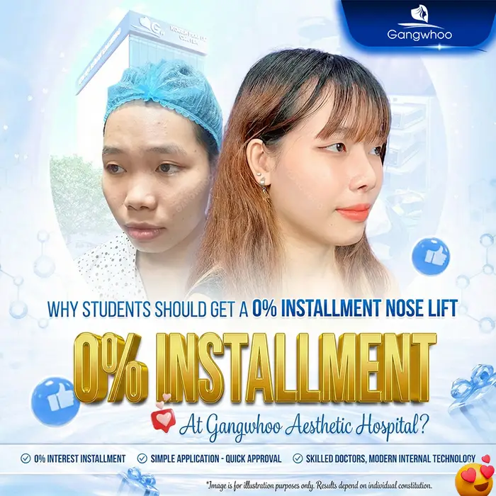 0% Installment Rhinoplasty – Achieve a Beautiful Nose Without Financial Pressure