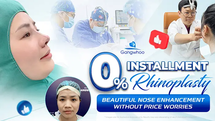 0% Installment Rhinoplasty – Achieve a Beautiful Nose Without Financial Pressure