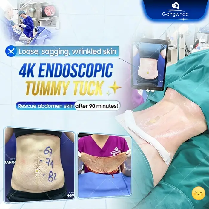Postpartum Abdominoplasty: Procedure and Costs