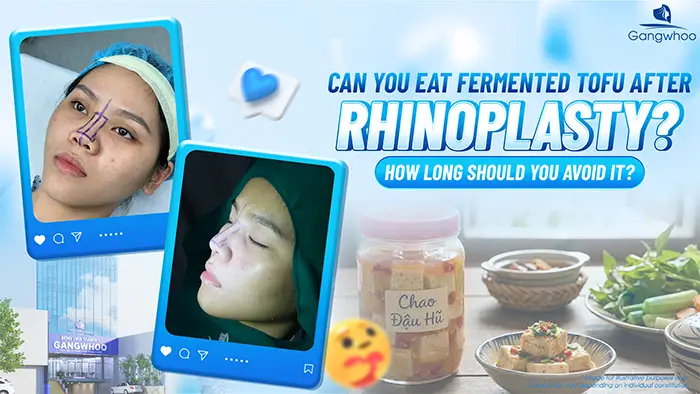 Can You Eat Fermented Tofu (Chao) After Rhinoplasty? How Long Should You Avoid It?