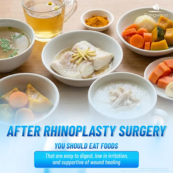 Can You Eat Glass Noodles After Rhinoplasty? How Long Should You Wait?