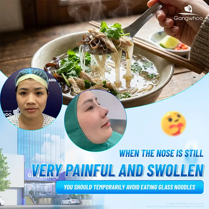 Can You Eat Glass Noodles After Rhinoplasty? How Long Should You Wait?