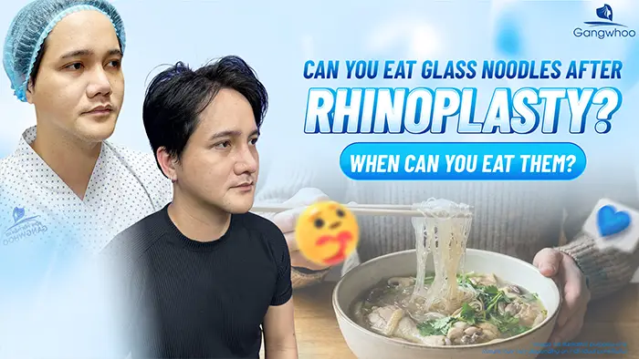 Can You Eat Glass Noodles After Rhinoplasty? How Long Should You Wait?