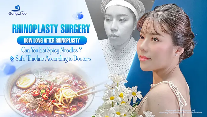 How Long After Rhinoplasty Can You Eat Spicy Noodles? A Safe Timeline According to Doctors