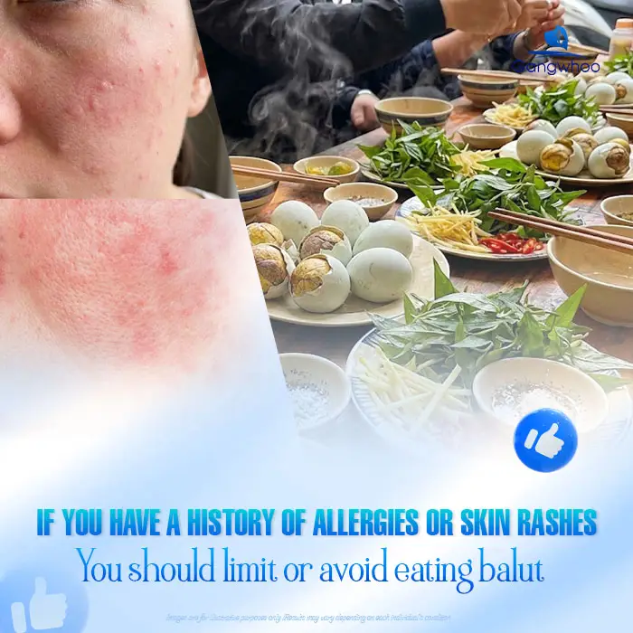 How Long After Rhinoplasty Can You Eat Balut? A Doctor Explains