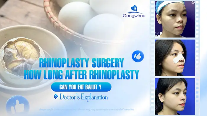 How Long After Rhinoplasty Can You Eat Balut? A Doctor Explains