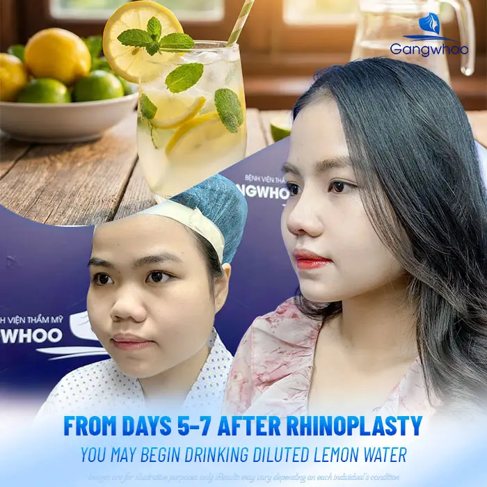 Can You Drink Lemon Water After Rhinoplasty? Doctor’s Explanation
