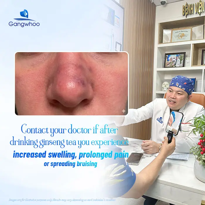 Can You Drink Ginseng Tea After Rhinoplasty? A Specialist’s Explanation