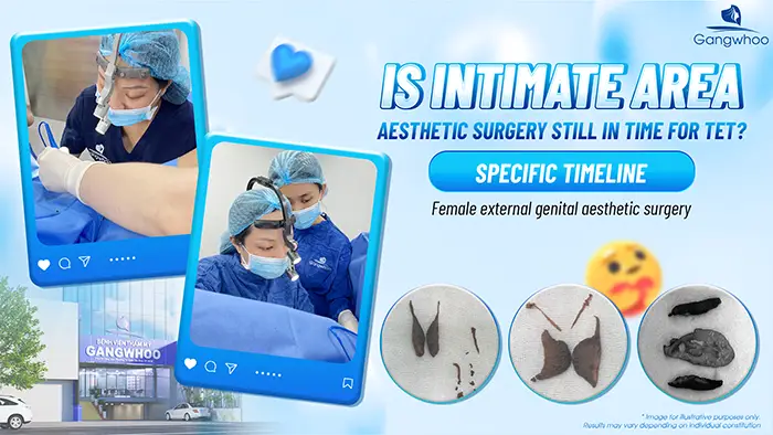 Is It Still in Time for Intimate Area Aesthetic Procedures Before Tet? A Clear Timeline
