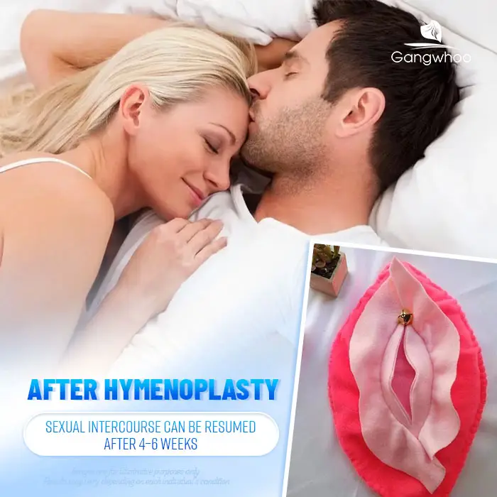 Will There Be Bleeding During Intercourse After Hymen Repair? Doctor’s Explanation