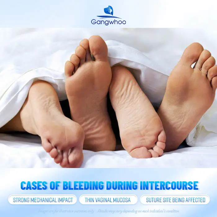 Will There Be Bleeding During Intercourse After Hymen Repair? Doctor’s Explanation