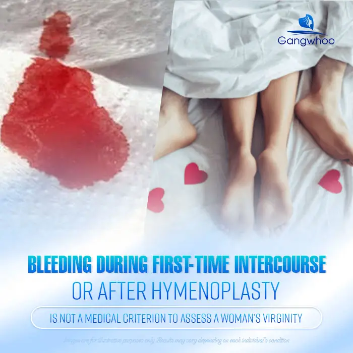 Will There Be Bleeding During Intercourse After Hymen Repair? Doctor’s Explanation