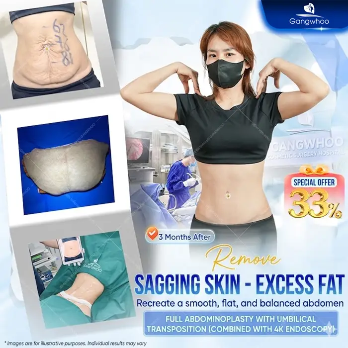 Abdominoplasty: What Is It? Cost, Recovery & Real Results