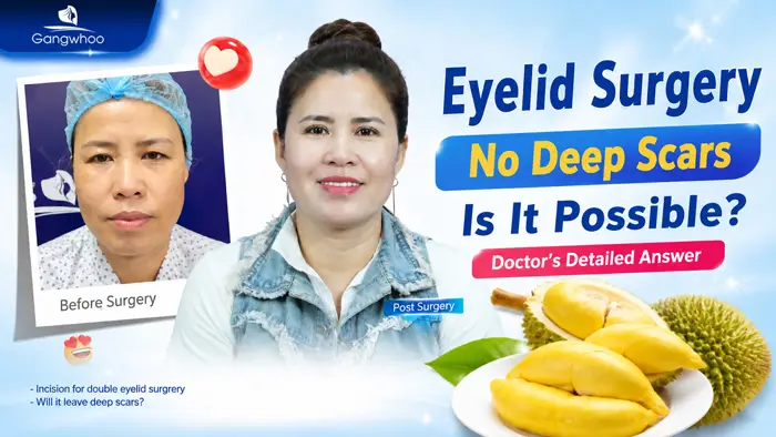 Can I Eat Durian After Double Eyelid Surgery? Detailed Doctor’s Answer