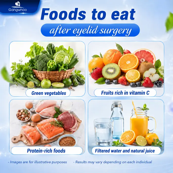 Can I Eat Durian After Double Eyelid Surgery? Detailed Doctor’s Answer