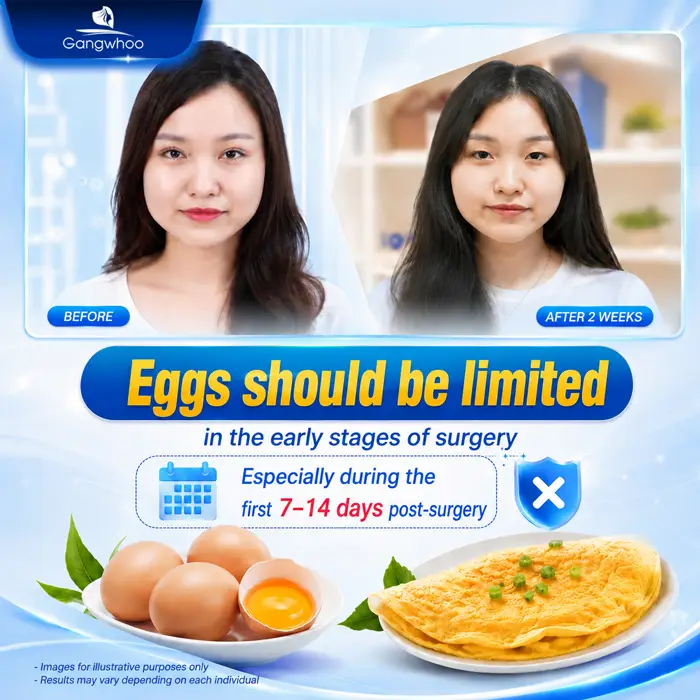 Can You Eat Eggs After Eyelid Surgery? A Professional Medical Perspective