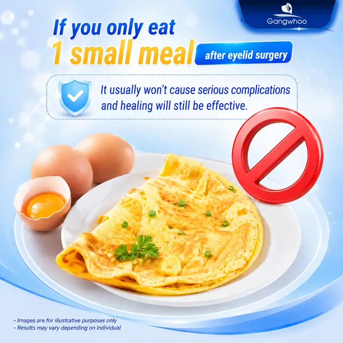 Can You Eat Eggs After Eyelid Surgery? A Professional Medical Perspective