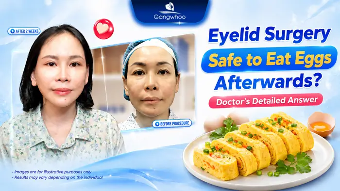 Can You Eat Eggs After Eyelid Surgery? A Professional Medical Perspective