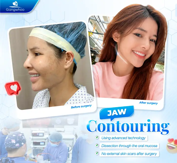 Does Jaw Reduction Surgery Leave Scars? Cases That May Increase the Risk of Scarring